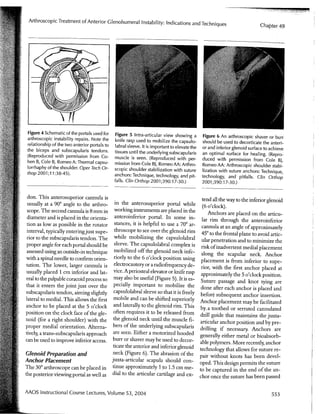 Arthroscopic Treatment of Anterior Glenohumeral Instability Indications and Techniques | Vail Sports Medicine