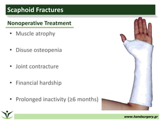www.handsurgery.gr
Scaphoid Fractures
• Muscle atrophy
• Disuse osteopenia
• Joint contracture
• Financial hardship
• Prol...