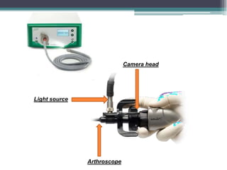 Principles of Arthroscopy and instruments | PDF