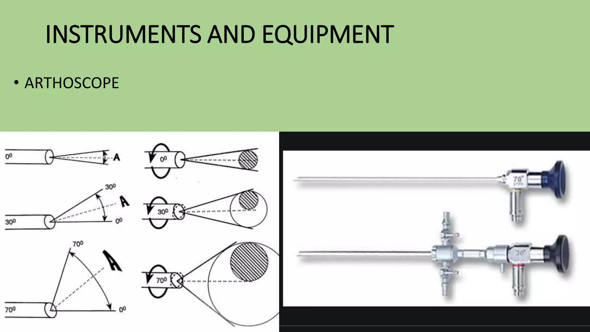 HISTORY OF ARTHROSCOPY H ck28 pptx history-of-arthroscopy-h-ck28-pptx
