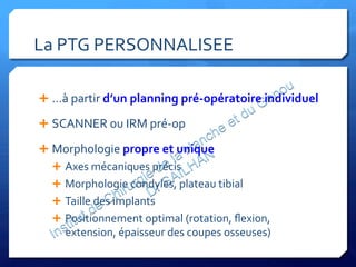 La	
  PTG	
  PERSONNALISEE	
  	
  
	
  
	
  
Ê …à	
  partir	
  d’un	
  planning	
  pré-­‐opératoire	
  individuel	
  
Ê SCANNER	
  ou	
  IRM	
  pré-­‐op	
  
Ê Morphologie	
  propre	
  et	
  unique	
  
Ê  Axes	
  mécaniques	
  précis	
  
Ê  Morphologie	
  condyles,	
  plateau	
  tibial	
  
Ê  Taille	
  des	
  implants	
  
Ê  Positionnement	
  optimal	
  (rotation,	
  ﬂexion,	
  
extension,	
  épaisseur	
  des	
  coupes	
  osseuses)	
  
 