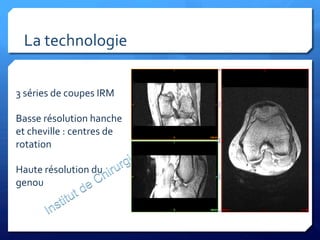 La	
  technologie	
  
3	
  séries	
  de	
  coupes	
  IRM	
  
	
  
Basse	
  résolution	
  hanche	
  
et	
  cheville	
  :	
  centres	
  de	
  
rotation	
  
	
  
Haute	
  résolution	
  du	
  
genou	
  
 