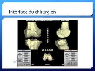 Interface	
  du	
  chirurgien	
  
 