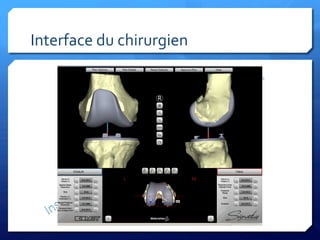 Interface	
  du	
  chirurgien	
  
 
