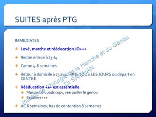 SUITES	
  après	
  PTG	
  
IMMEDIATES	
  
Ê  Levé,	
  marche	
  et	
  rééducation	
  JO+++	
  
Ê  Redon	
  enlevé	
  à	
  J3-­‐J4	
  
Ê  Canne	
  4-­‐6	
  semaines	
  	
  
Ê  Retour	
  à	
  domicile	
  à	
  J5	
  avec	
  KINE	
  TOUS	
  LES	
  JOURS	
  ou	
  départ	
  en	
  
CENTRE	
  
Ê  Rééducation	
  +++	
  est	
  essentielle	
  	
  
Ê  Muscler	
  le	
  quadriceps,	
  verrouiller	
  le	
  genou	
  
Ê  Escaliers+++	
  
Ê  AC	
  6	
  semaines,	
  bas	
  de	
  contention	
  8	
  semaines	
  
 