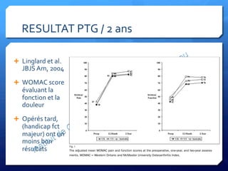 RESULTAT	
  PTG	
  /	
  2	
  ans	
   2183
THE JOURNAL OF BONE & JOINT SURGER Y · JBJS.ORG
VOLUME 86-A · NUMBER 10 · OCTOBER 2004
PREDICTING THE OUTCOME OF
TOTAL KNEE ARTHROPLASTY
the strongest determinants. The patients in the United King- terms of the WOMAC function score at one year; this
Fig. 1
The adjusted mean WOMAC pain and function scores at the preoperative, one-year, and two-year assess-
ments. WOMAC = Western Ontario and McMaster University Osteoarthritis Index.
Ê  Linglard	
  et	
  al.	
  
JBJS	
  Am,	
  2004	
  
Ê  WOMAC	
  score	
  
évaluant	
  la	
  
fonction	
  et	
  la	
  
douleur	
  
Ê  Opérés	
  tard,	
  
(handicap	
  fct	
  
majeur)	
  ont	
  un	
  
moins	
  bon	
  
résultats	
  	
  
 