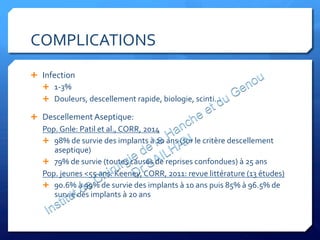 COMPLICATIONS	
  
Ê  Infection	
  
Ê  1-­‐3%	
  
Ê  Douleurs,	
  descellement	
  rapide,	
  biologie,	
  scinti…	
  	
  
Ê  Descellement	
  Aseptique:	
  	
  
Pop.	
  Gnle:	
  Patil	
  et	
  al.,	
  CORR,	
  2014	
  
Ê  98%	
  de	
  survie	
  des	
  implants	
  à	
  20	
  ans	
  (sur	
  le	
  critère	
  descellement	
  
aseptique)	
  
Ê  79%	
  de	
  survie	
  (toutes	
  causes	
  de	
  reprises	
  confondues)	
  à	
  25	
  ans	
  
Pop.	
  jeunes	
  <55	
  ans:	
  Keeney,	
  CORR,	
  2011:	
  revue	
  littérature	
  (13	
  études)	
  
Ê  90.6%	
  à	
  99%	
  de	
  survie	
  des	
  implants	
  à	
  10	
  ans	
  puis	
  85%	
  à	
  96.5%	
  de	
  
survie	
  des	
  implants	
  à	
  20	
  ans	
  
 