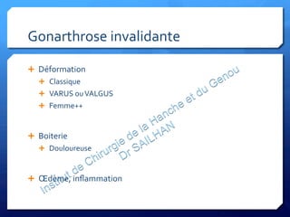 Gonarthrose	
  invalidante	
  
Ê  Déformation	
  
Ê  Classique	
  
Ê  VARUS	
  ou	
  VALGUS	
  
Ê  Femme++	
  
Ê  Boiterie	
  
Ê  Douloureuse	
  
Ê  Œdème,	
  inﬂammation	
  
 