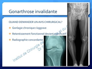 Gonarthrose	
  invalidante	
  
QUAND	
  DEMANDER	
  UN	
  AVIS	
  CHIRURGICAL?	
  
Ê  Gonlagie	
  chronique	
  s’aggrave	
  
Ê  Retentissement	
  fonctionnel	
  devient	
  signiﬁcatif	
  
Ê  Radiographie	
  concordante	
  
 