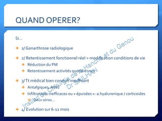 QUAND	
  OPERER?	
  
Si…	
  
Ê  1/	
  Gonarthrose	
  radiologique	
  
Ê  2/	
  Retentissement	
  fonctionnel	
  réel	
  =	
  modiﬁcation	
  conditions	
  de	
  vie	
  
Ê  Réduction	
  du	
  PM	
  
Ê  Retentissement	
  activités	
  quotidiennes	
  
Ê  3/	
  Tt	
  médical	
  bien	
  conduit	
  insuﬃsant	
  
Ê  Antalgiques,	
  AINS	
  	
  
Ê  Inﬁltrations	
  ineﬃcaces	
  ou	
  «	
  épuisées	
  »:	
  a.hyaluronique	
  /	
  corticoides	
  
Ê  Deux	
  séries…	
  
Ê  4/	
  Evolution	
  sur	
  6-­‐12	
  mois	
  
 