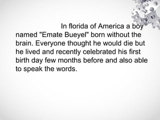 In florida of America a boy
named "Emate Bueyel" born without the
brain. Everyone thought he would die but
he lived and recently celebrated his first
birth day few months before and also able
to speak the words.
 