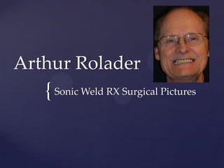 {
Arthur Rolader
Sonic Weld RX Surgical Pictures
 
