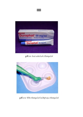 บบที่ 2 โรคฟนผุในเด็กปฐมวัย
                               94




         รูปที่ 2-9 ตัวอยางผลิตภัณฑวารนิชฟลูออไรด




รูปที่ 2-10 วิธีใชวารนิชฟลูออไรด โดยใชพูกนจุมวารนชฟลูออไรด
                                              ั         ิ
 