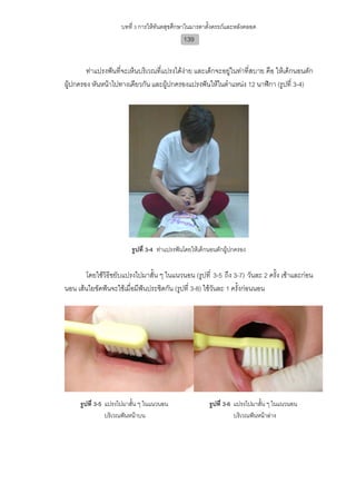 บทที่ 3 การใหทันตสุขศึกษาในมารดาตั้งครรภและหลังคลอด
                                            139


        ทาแปรงฟนที่จะเห็นบริเวณที่แปรงไดงาย และเด็กจะอยูในทาที่สบาย คือ ใหเด็กนอนตัก
ผูปกครอง หันหนาไปทางเดียวกัน และผูปกครองแปรงฟนใหในตําแหนง 12 นาฬิกา (รูปที่ 3-4)




                        รูปที่ 3-4 ทาแปรงฟนโดยใหเด็กนอนตักผูปกครอง


       โดยใชวิธีขยับแปรงไปมาสั้น ๆ ในแนวนอน (รูปที่ 3-5 ถึง 3-7) วันละ 2 ครั้ง เชาและกอน
นอน เสนใยขัดฟนจะใชเมื่อมีฟนประชิดกัน (รูปที่ 3-8) ใชวันละ 1 ครั้งกอนนอน




     รูปที่ 3-5 แปรงไปมาสั้น ๆ ในแนวนอน                รูปที่ 3-6 แปรงไปมาสั้น ๆ ในแนวนอน
                บริเวณฟนหนาบน                                   บริเวณฟนหนาลาง
 