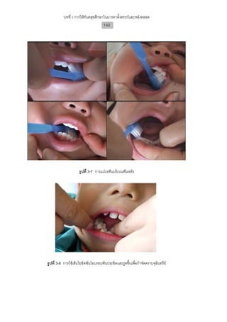บทที่ 3 การใหทันตสุขศึกษาในมารดาตั้งครรภและหลังคลอด
                                     140




                     รูปที่ 3-7 การแปรงฟนบริเวณฟนหลัง




รูปที่ 3-8 การใชเสนใยขัดฟนโอบรอบฟนประชิดและรูดขึ้นเพื่อกําจัดคราบจุลินทรีย
 