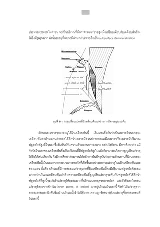 ทันตกรรมป้องกันในเด็กและวัยรุ่น 