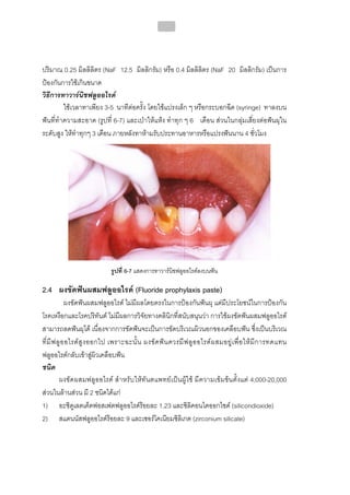 ทันตกรรมป้องกันในเด็กและวัยรุ่น 