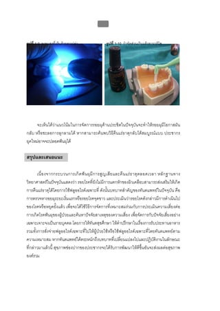 บทที่ 1 โรคฟนผุ
                                                 32


รูปที่ 1-9 ฉายแสงที่เห็นดวยตาเปลา                 รูปที่ 1-10 กําจัดสวนเกินแลวทาวารนิช




      จะเห็นไดวาแนวโนมในการจัดการรอยผุดานประชิดในปจจุบันจะทําใหรอยผุมีโอกาสผัน
กลับ หรือชะลอการลุกลามได หากสามารถคนพบวิธีคืนแรธาตุกลับไดสมบูรณแบบ ประชากร
ยุคใหมอาจจะปลอดฟนผุได

สรุปและเสนอแนะ

       เนื่ อ งจากกระบวนการเกิ ด ฟ น ผุ มี ก ารสู ญ เสี ย และคื น แร ธ าตุ ต ลอดเวลา หลั ก ฐานทาง
วิทยาศาสตรในปจจุบันแสดงวา รอยโรคที่ยังไมมีการแตกหักของผิวเคลือบสามารถสงเสริมใหเกิด
การคืนแรธาตุไดโดยการใชฟลูออไรดเฉพาะที่ ดังนั้นบทบาทสําคัญของทันตแพทยในปจจุบัน คือ
การตรวจหารอยผุระยะเริ่มแรกหรือรอยโรคจุดขาว และประเมินวารอยโรคดังกลาวมีการดําเนินไป
ของโรคหรือหยุดยั้งแลว เพื่อจะไดใชวิธีการจัดการที่เหมาะสมรวมกับการประเมินความเสี่ยงตอ
การเกิดโรคฟนผุของผูปวยและคนหาปจจัยสาเหตุของความเสี่ยง เพื่อจัดการกับปจจัยเสี่ยงอยาง
เฉพาะเจาะจงเปนรายบุคคล โดยการใหทันตสุขศึกษา ใหคําปรึกษาในเรื่องการรับประทานอาหาร
รวมทั้งการสั่งจายฟลูออไรดเฉพาะที่ไปใหผูปวยใชหรือใชฟลูออไรดเฉพาะที่โดยทันตแพทยตาม
ความเหมาะสม หากทันตแพทยไดตระหนักถึงบทบาทที่เปลี่ยนแปลงไปและปฏิบัติงานในลักษณะ
ที่กลาวมาแลวนี้ สุขภาพชองปากของประชากรจะไดรับการพัฒนาใหดีขึ้นอันจะสงผลตอสุขภาพ
องครวม
 