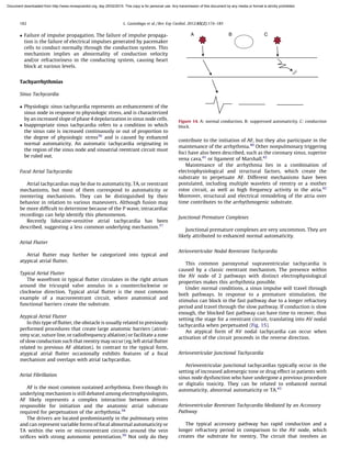 Failure of impulse propagation. The failure of impulse propaga-
tion is the failure of electrical impulses generated by pacemaker
cells to conduct normally through the conduction system. This
mechanism implies an abnormality of conduction velocity
and/or refractoriness in the conducting system, causing heart
block at various levels.
Tachyarrhythmias
Sinus Tachycardia
 Physiologic sinus tachycardia represents an enhancement of the
sinus node in response to physiologic stress, and is characterized
by an increased slope of phase 4 depolarization in sinus node cells.
 Inappropriate sinus tachycardia refers to a condition in which
the sinus rate is increased continuously or out of proportion to
the degree of physiologic stress36
and is caused by enhanced
normal automaticity. An automatic tachycardia originating in
the region of the sinus node and sinoatrial reentrant circuit must
be ruled out.
Focal Atrial Tachycardia
Atrial tachycardias may be due to automaticity, TA, or reentrant
mechanisms, but most of them correspond to automaticity or
reentering mechanisms. They can be distinguished by their
behavior in relation to various maneuvers. Although fusion may
be more difﬁcult to determine because of the P wave, intracardiac
recordings can help identify this phenomenon.
Recently lidocaine-sensitive atrial tachycardia has been
described, suggesting a less common underlying mechanism.37
Atrial Flutter
Atrial ﬂutter may further be categorized into typical and
atypical atrial ﬂutter.
Typical Atrial Flutter
The wavefront in typical ﬂutter circulates in the right atrium
around the tricuspid valve annulus in a counterclockwise or
clockwise direction. Typical atrial ﬂutter is the most common
example of a macroreentrant circuit, where anatomical and
functional barriers create the substrate.
Atypical Atrial Flutter
In this type of ﬂutter, the obstacle is usually related to previously
performed procedures that create large anatomic barriers (atriot-
omy scar, suture line, or radiofrequency ablation) or facilitate a zone
of slow conduction such that reentry may occur (eg, left atrial ﬂutter
related to previous AF ablation). In contrast to the typical form,
atypical atrial ﬂutter occasionally exhibits features of a focal
mechanism and overlaps with atrial tachycardias.
Atrial Fibrillation
AF is the most common sustained arrhythmia. Even though its
underlying mechanism is still debated among electrophysiologists,
AF likely represents a complex interaction between drivers
responsible for initiation and the anatomic atrial substrate
required for perpetuation of the arrhythmia.38
The drivers are located predominantly in the pulmonary veins
and can represent variable forms of focal abnormal automaticity or
TA within the vein or microreentrant circuits around the vein
oriﬁces with strong autonomic potentiation.39
Not only do they
contribute to the initiation of AF, but they also participate in the
maintenance of the arrhythmia.40
Other nonpulmonary triggering
foci have also been described, such as the coronary sinus, superior
vena cava,41
or ligament of Marshall.42
Maintenance of the arrhythmia lies in a combination of
electrophysiological and structural factors, which create the
substrate to perpetuate AF. Different mechanisms have been
postulated, including multiple wavelets of reentry or a mother
rotor circuit, as well as high frequency activity in the atria.42
Moreover, structural and electrical remodeling of the atria over
time contributes to the arrhythmogenic substrate.
Junctional Premature Complexes
Junctional premature complexes are very uncommon. They are
likely attributed to enhanced normal automaticity.
Atrioventricular Nodal Reentrant Tachycardia
This common paroxysmal supraventricular tachycardia is
caused by a classic reentrant mechanism. The presence within
the AV node of 2 pathways with distinct electrophysiological
properties makes this arrhythmia possible.
Under normal conditions, a sinus impulse will travel through
both pathways. In response to a premature stimulation, the
stimulus can block in the fast pathway due to a longer refractory
period and travel through the slow pathway. If conduction is slow
enough, the blocked fast pathway can have time to recover, thus
setting the stage for a reentrant circuit, translating into AV nodal
tachycardia when perpetuated (Fig. 15).
An atypical form of AV nodal tachycardia can occur when
activation of the circuit proceeds in the reverse direction.
Atrioventricular Junctional Tachycardia
Atrioventricular junctional tachycardias typically occur in the
setting of increased adrenergic tone or drug effect in patients with
sinus node dysfunction who have undergone a previous procedure
or digitalis toxicity. They can be related to enhanced normal
automaticity, abnormal automaticity or TA.43
Atrioventricular Reentrant Tachycardia Mediated by an Accessory
Pathway
The typical accessory pathway has rapid conduction and a
longer refractory period in comparison to the AV node, which
creates the substrate for reentry. The circuit that involves an
A B C
Figure 14. A: normal conduction. B: suppressed automaticity. C: conduction
block.
L. Gaztan˜aga et al. / Rev Esp Cardiol. 2012;65(2):174–185182
Document downloaded from http://www.revespcardiol.org, day 25/02/2019. This copy is for personal use. Any transmission of this document by any media or format is strictly prohibited.
 
