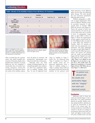 Article clinical splinting | PDF | Oral care | Personal Care
