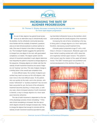 1
American Journal of Orthodontics and Dentofacial Orthopedics
THE USE OF PROPEL TO INCREASE
THE RATE OF ALIGNER PROGRESSION
Dr. Thomas S. Shipley discusses increasing the bone remodeling rate
for more rapid aligner progression
The use of clear aligners has gained broad accep-
tance as an alternative way to orthodontically move
the dentition. As the orthodontic community becomes
more familiar with this modality of treatment, questions
arise as to best clinical practices to achieve optimal re-
sults. One area of interest is how often to change align-
ers. The Invisalign® System suggests the optimal time
to change from one aligner to the next, with good patient
compliance, is 2 weeks. The aligner system and the
amount of movement prescribed in each aligner determine
how frequently the patient is required to change aligners in
the sequence. Changing aligners at a faster rate than the
velocity of tooth movement would be one cause of align-
ers not “tracking” over time. This rate of aligner change is
a limiting factor in the overall case completion time.
In more difficult cases, the number of aligners pre-
scribed may reach as many as 40 to 60 aligners, with
even more in the most difficult cases. To the patient,
who can quickly do the math, and to the clinician, who
knows “refinement” or “auxiliary treatment” has not even
been accounted for yet, the future of the orthodontic
treatment becomes daunting. In these cases, or with
any case, where increased velocity of tooth movement
is desired, a way to change aligners at a more rapid
pace becomes attractive.
The rate of tooth movement is dependent on the rate
of the physiologic process of bone remodeling.1,2
If this
rate of bone remodeling is increased, then the rate at
which aligners should be changed increases also. Failing
to change the aligners fast enough to coincide with the
velocity of tooth movement would be equivalent to plac-
ing intermittent orthodontic forces on the dentition, which
could actually slow the overall progress of the movement.
Increasing the rate of bone remodeling is the key
to being able to change aligners at a more rapid pace,
therefore, decreasing overall treatment time.
A female patient presented at age 21 with a mild
Class II, Division 2 malocclusion. Moderate upper and
lower dental crowding existed with a 60% deep bite
and negatively inclined upper incisors. The patient’s
chief concern was the rotation of the upper left lateral
incisor. The CBCT showed good root parallelism and
normal development of the dentition (Figures 1-7).
Figure 1
Figure 2
Figure 4
Figure 3
Figure 5
INCREASING THE RATE OF
ALIGNER PROGRESSION
 