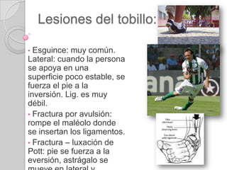  Tendón calcáneo: parte post. del tobillo. 4