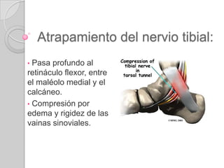  Tendón del peroneo largo y corto:  post. e inf. al maléolo lat. 543125