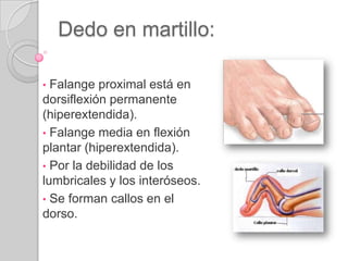  Tendón del tibialant: parte med. del dorso.