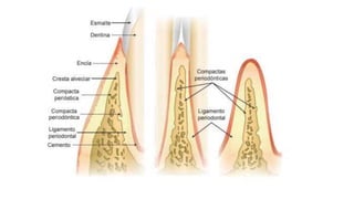 Articulación dentoalveolar - Exodoncia (1).pptx