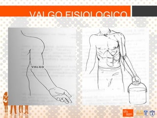 VALGO FISIOLOGICO

 