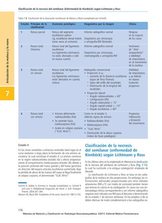 116
Clasificación de la necrosis del semilunar (Enfermedad de Kienböck) según Lichtmann y Ross
7
Articulacióndelamuñecaylamano
Estadio 4
En las zonas sometidas a esfuerzos anómalos tiene lugar en el
curso evolutivo a largo plazo la formación de una artrosis se-
cundaria, la cual constituye el estadio 4. La artrosis comienza
en la región radioescafoidea (estadio 4a) y afecta progresiva-
mente al compartimento mediocarpiano (estadio 4b) debido a
la posición profunda del hueso grande y del hueso ganchoso
en dirección del espacio articular escafolunar aumentado. Bajo
la pérdida de altura de los huesos del carpo se llega finalmente
al colapso carpiano, el denominado “SLAC Wrist”.
━Schmitt R, Stäbler A, Krimmer H. Karpale Instabilitäten In: Schmitt R
und Lanz U. Bildgebende Diagnostik der Hand. 2. Aufl. Stuttgart:
Thieme; 2004;261-284.
Watson HK, Black DM. Instabilities of the wrist. Hand Clin 1987;3:103.
Clasificación de la necrosis
del semilunar (enfermedad de
Kienböck) según Lichtmann y Ross
En los últimos años se ha implantado enAlemania la clasificación
de la necrosis del semilunar de Lichtmann y Ross (Fig. 7.13),
la cual ha sustituido a la antigua catalogación empleada de
Decoulx.
La clasificación de Lichtmann y Ross se basa en las radio-
grafías de la muñeca en dos proyecciones. Sin embargo, las in-
formaciones adicionales proporcionadas por otros métodos
aclaratorios (RM y TC con medio de contraste) también tienen
que tenerse en cuenta en la catalogación. En casos con una sin-
tomatología clínica correspondiente y con informe radiográfico
negativo está indicada una RM para el descarte o demostración
de un estadio 1 de necrosis semilunar. En los estadios 2-4b se
deben efectuar de modo complementario a las radiografías ex-
Tabla 7.3 Clasificación de la disociación escafolunar de Watson y Black (completada por Schmitt)
Estadio Principio de la
clasificación
Anatomía patológica Diagnóstico por la imagen Clínica
1 Rotura parcial Rotura del segmento
escafolunar palmar
Lig. escafolunar dorsal intacto
(raras veces al contrario)
Informe radiográfico normal
Diagnóstico por artroscopia
o artrografía-RM (limitado)
Ninguna
en la mayoría
de los casos
2 Rotura total.
Dinámico
Rotura total del ligamento
escafolunar
Los ligamentos extrínsecos
no están afectados o sólo
en escasa cuantía
Informe radiográfico normal
Diagnóstico por artroscopia,
cinematografía o artrografía-RM
Fenómeno
de “click/
atrapamiento”
o debilidad
de empuñadura
en el movimiento
de la muñeca
3 Rotura total
sin artrosis
Rotura total del ligamento
escafolunar
Los ligamentos extrínsecos
están afectados en cuantía
notoria
Radiografía convencional:
• Proyección d.-p.:
• aumento de la distancia escafolunar
(signo de Terry-Thomas)
• Signo del anillo del escafoides
• Disminución de la longitud del
escafoides
• Proyección lateral:
• Ángulo radioescafoideo > 60°
• Configuración-DISI
• Ángulo radiocubital > 15°
• Ángulo capital-cubital < –15°
• Ángulo escafolunar > 60°
Debilidad
de empuñadura
y ya dolores
en reposo.
Evolución
progresiva
4 Rotura total
con artrosis
• Artrosis deformante:
radioescafoidea (IVa)
• Se extiende hacia
mediocarpiana (IVb)
• Acaba en colapso carpiano
(“SLAC Wrist”)
Como en el estadio 3.
Además signos de artrosis:
• Radioescafoideo (IVa)
• Mediocarpiana (IVb)
• “SLAC Wrist”
• Disminución de la altura carpiana
(índice de Youm patológico)
Progresiva
inflamación
y limitación
del movimiento
07-Articulación de la muñeca y la mano:Maquetación 1 04/06/13 12:35 Página 116
Métodos de Medición y Clasificación en Radiología Musculoesquelética. ©2013. Editorial Médica Panamericana.
 