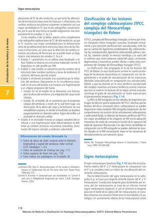 ploraciones de TC de alta resolución, ya que tanto las alteracio-
nes de la estructura ósea como las fracturas o infracciones y los
cambios artrósicos secundarios incipientes se detectan con una
mayor sensibilidad en TC que en las radiografías convenciona-
les, por lo que de esta forma se pueden diagnosticar más tem-
pranamente los estadios 2, 3a y 4.
En los estadios 2-4b se deben realizar como complemento
a las radiografías exploraciones deTC de alta resolución, ya que
la TC muestra una mayor sensibilidad para la demostración
tanto de las alteraciones de la estructura ósea como de las frac-
turas o infracciones, así como para la detección de cambios ar-
trósicos secundarios, de forma que así se puede hacer un diag-
nóstico más temprano los estadios 2, 3a y 4.
• Estadio 1: característico es un edema óseo localizado o di-
fuso.Todavía se observa una estructura trabecular normal. El
diagnóstico es sólo posible por RM.
• Estadio 2: este estadio se caracteriza por los cambios de la
estructura ósea (cambios quísticos y zonas de esclerosis). El
contorno del hueso persiste intacto.
• Estadio 3: el tránsito al estadio 3 se caracteriza por la infrac-
ción del semilunar (típicamente en la circunferencia proxi-
mal). En el curso del estadio 3 se instaura una fragmentación
y un colapso progresivo del hueso.
• Estadio 3a: en el estadio 3a se demuestra una fractura,
pero la altura del semilunar y la integridad del carpo están
intactas.
• Estadio 3b: el estadio 3b se caracteriza por el progresivo
colapso del semilunar, a través de lo cual tiene lugar una
disminución de la altura del carpo y la formación de una
inestabilidad carpiana, en donde el escafoides se desplaza
progresivamente en dirección palmar (Signo del anillo) y el
piramidal en dirección cubital.
• Estadio 4: en el estadio 4 existe un colapso completo del se-
milunar o una fragmentación total. Adicionalmente se deli-
mitan ya cambios artrósicos secundarios (osteofitos, dismi-
nución del espacio articular y esclerosis subcondral).
━Lichtmann DM, Ross G. Revascularization of the lunate in Kienböck´s
disease. In: Gelbermann RH, ed. The wrist. New York: Raven Press;
1994;363-372.
Schmitt R, Krimmer H. Osteonekrosen am Handskelett. In: Schmitt R
und Lanz U, Bildgebende Diagnostik der Hand. 2 Aufl. Stuttgart:
Thieme; 2004.
Clasificación de las lesiones
del complejo cubitocarpiano (TFCC,
complejo del fibrocartílago
triangular) de Palmer
ElTFCC,complejo del fibrocartílago triangular,se forma por el dis-
cus triangularis (disco triangular) avascular, localizado central-
mente, y por porciones periféricas bien vascularizadas, entre las
que se cuentan los ligamentos estabilizadores (lig. cubitosemilu-
nar, lig. cubitopiramidal, ligamentos radiocubitales palmar y dor-
sal, lig. colateral cubital), el menisco homólogo y la vaina del
m. extensor carpi ulnaris (extensor cubital del carpo). Las lesiones
degenerativas y traumáticas pueden afectar a todos estos com-
ponentes del complejo del fibrocartílago triangular (TFCC).
La clasificación más propagada es la de las lesiones del
TFCC de Palmer. En esta clasificación se tiene en cuenta la etio-
logía de las lesiones (traumáticas en comparación con las de-
generativas) y el grado de vascularización de las estructuras
afectadas (avascularizado en comparación con vascularizado).
Debido a que las lesiones en la zona periférica vascularizada
del complejo muestran una buena tendencia curativa, mientras
que ésta es mala en las lesiones de la región central avascular,
constituye el grado de vascularización un factor esencial para
el planteamiento terapéutico (Fig. 7.14).
La RM y la RM-artrografía son los métodos de diagnóstico por
imagen de elección para la exploración delTFCC.Mientras que las
lesiones del discus ulcocarpalis (disco cubitocarpiano) se pueden
diagnosticar mejor mediante RM-artrografía (exploración de dos
compartimentos con punción de las articulaciones radiocarpianas
y radiocubital distal), se detectan las lesiones periféricas del TFCC
con mayor sensibilidad en las imágenes de RM tras la aplicación
intravenosa de medio de contraste en función de la captación del
tejido de reparación fibrovascular. Con algo menor sensibilidad en
comparación con la RM-artrografía se pueden delimitar las lesio-
nes discales en la RM convencional, mejor en las secuencias de
densidad protónica con saturación grasa.
━Palmer AK. Triangular fibrocartilage lesions: A classification. J Hand
Surg 1989;14A:594-606.
Signo metacarpiano
El signo metacarpiano (positivo) (Fig. 7.15) describe el acorta-
miento relativo del 4° y 5° metacarpiano en comparación con
el 3° y se considera como un indicio de una alteración del cre-
cimiento metacarpiano.
Para la determinación del signo metacarpiano en la radio-
grafía d.-p. se traza una tangente al borde exterior del 4° y 5°
metacarpiano. Cuando esta tangente pasa distalmente, por en-
cima, del 3er metacarpiano se trata de un informe normal
(signo metacarpiano negativo). Si, por el contrario, la tangente
pasa por el borde de la cabeza del 3er metacarpiano, se consi-
dera entonces una situación límite entre la normalidad y lo pa-
tológico. Un acortamiento relativo de los metacarpianos existe
118
Signo metacarpiano
7
Articulacióndelamuñecaylamano
Diferenciación del estadio 3b/estadio 3a
• Índice de altura de Stahl: cociente entre el diámetro
longitudinal y sagital del semilunar. Valor normal:
0,53. Patológico: < 0,5
• Índice de traslación de Chamay (ver pág. 111)
• Índice carpiano de Youm (ver pág. 110)
• Estos índices son patológicos en el estadio 3b
07-Articulación de la muñeca y la mano:Maquetación 1 04/06/13 12:35 Página 118
Métodos de Medición y Clasificación en Radiología Musculoesquelética. ©2013. Editorial Médica Panamericana.
 