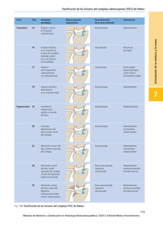 119
Clasificación de las lesiones del complejo cubitocarpiano (TFCC) de Palmer
7
Articulacióndelamuñecaylamano
Fig. 7.14 Clasificación de las lesiones del complejo TFCC de Palmer.
07-Articulación de la muñeca y la mano:Maquetación 1 04/06/13 12:35 Página 119
Métodos de Medición y Clasificación en Radiología Musculoesquelética. ©2013. Editorial Médica Panamericana.
 