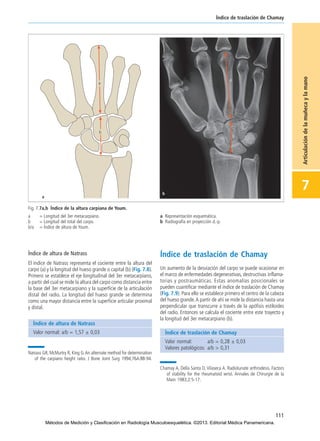 Índice de altura de Natrass
El índice de Natrass representa el cociente entre la altura del
carpo (a) y la longitud del hueso grande o capital (b) (Fig. 7.8).
Primero se establece el eje longitudinal del 3er metacarpiano,
a partir del cual se mide la altura del carpo como distancia entre
la base del 3er metacarpiano y la superficie de la articulación
distal del radio. La longitud del hueso grande se determina
como una mayor distancia entre la superficie articular proximal
y distal.
━Natrass GR, McMurtry R, King G.An alternate method for determination
of the carpiano height ratio. J Bone Joint Surg 1994;76A:88-94.
Índice de traslación de Chamay
Un aumento de la desviación del carpo se puede ocasionar en
el marco de enfermedades degenerativas, destructivas inflama-
torias y postraumáticas. Estas anomalías posicionales se
pueden cuantificar mediante el índice de traslación de Chamay
(Fig. 7.9). Para ello se establece primero el centro de la cabeza
del hueso grande.A partir de ahí se mide la distancia hasta una
perpendicular que transcurre a través de la apófisis estiloides
del radio. Entonces se calcula el cociente entre este trayecto y
la longitud del 3er metacarpiano (b).
━Chamay A, Della Santa D, Vilaseca A. Radiolunate arthrodesis. Factors
of stability for the rheumatoid wrist. Annales de Chirurgie de la
Main 1983;2:5-17.
111
Índice de traslación de Chamay
7
Articulacióndelamuñecaylamano
Fig. 7.7a,b Índice de la altura carpiana de Youm.
a = Longitud del 3er metacarpiano. a Representación esquemática.
b = Longitud del total del carpo. b Radiografía en proyección d.-p.
b/a = Índice de altura de Youm.
Índice de altura de Natrass
Valor normal: a/b = 1,57 ± 0,03 Índice de traslación de Chamay
Valor normal: a/b = 0,28 ± 0,03
Valores patológicos: a/b > 0,31
07-Articulación de la muñeca y la mano:Maquetación 1 04/06/13 12:35 Página 111
Métodos de Medición y Clasificación en Radiología Musculoesquelética. ©2013. Editorial Médica Panamericana.
 