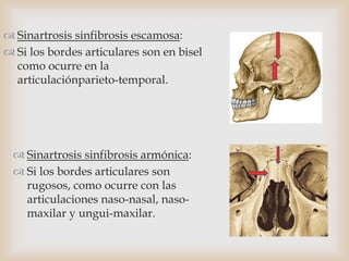  Sinartrosis sinfibrosis escamosa:
 Si los bordes articulares son en bisel
como ocurre en la
articulaciónparieto-temporal.
 Sinartrosis sinfibrosis armónica:
 Si los bordes articulares son
rugosos, como ocurre con las
articulaciones naso-nasal, naso-
maxilar y ungui-maxilar.
 