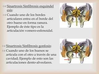  Sinartrosis Sinfibrosis esquindel
esis:
 Cuando uno de los bordes
articulares entra en el borde del
otro hueso en forma ranura.
Ejemplo de éste tipo es la
articulación vomero-esfenoidal.
 Sinartrosis Sinfibrosis gonfosis:
 Cuando uno de los huesos se
articula con el otro a través de una
cavidad; Ejemplo de esto son las
articulaciones dento-alveolares.
 