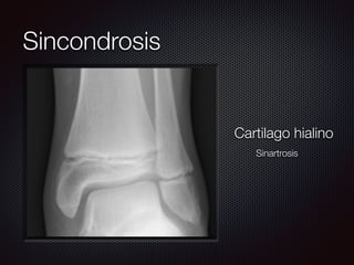 Sincondrosis
Cartilago hialino
Sinartrosis
 