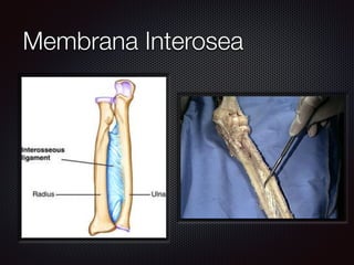 Membrana Interosea
 