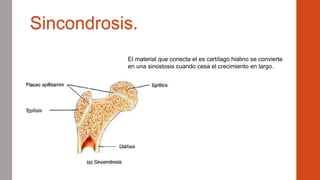 Sincondrosis.
El material que conecta el es cartílago hialino se convierte
en una sinostosis cuando cesa el crecimiento en largo.
 