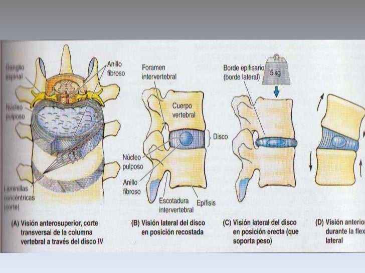Su deformidad elástica absorbe los movimientos bruscos</li></li></ul><li>