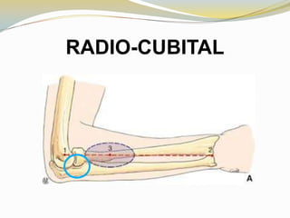 RADIO-CUBITAL

 