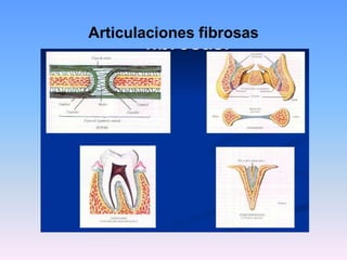 Articulaciones fibrosas
 