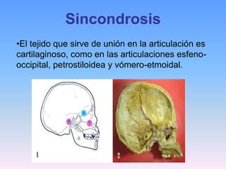 Sincondrosis
•El tejido que sirve de unión en la articulación es
cartilaginoso, como en las articulaciones esfeno-
occipital, petrostiloidea y vómero-etmoidal.
 