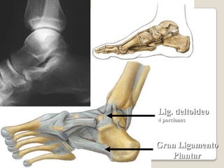 Articulación tibioperoneaEs una articulación sinovial plana que se establece entre la cara articular plana de la cabeza del perone y una cara articular parecida que se localiza posterolateralmente en el condilo lateral de la tibia 