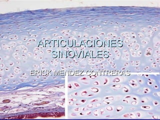 ARTICULACIONES SINOVIALES ERICK MENDEZ CONTRERAS 