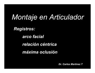 Montaje en Articulador
Registros:
    arco facial
    relación céntrica
    máxima oclusión

                        Dr. Carlos Martínez T