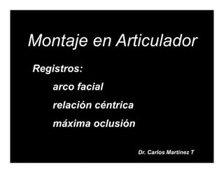 Montaje en Articulador
Registros:
arco facial
relación céntrica
máxima oclusión
Dr. Carlos Martínez T
 