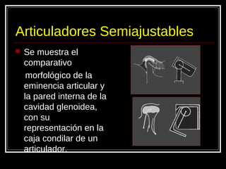 Articuladores Semiajustables
 Se muestra el
comparativo
morfológico de la
eminencia articular y
la pared interna de la
cavidad glenoidea,
con su
representación en la
caja condilar de un
articulador.
 