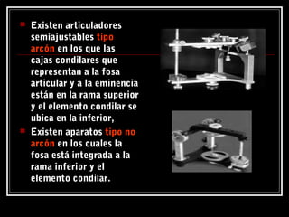  Existen articuladores
semiajustables tipotipo
arcónarcón en los que las
cajas condilares que
representan a la fosa
articular y a la eminencia
están en la rama superior
y el elemento condilar se
ubica en la inferior,
 Existen aparatos tipo notipo no
arcónarcón en los cuales la
fosa está integrada a la
rama inferior y el
elemento condilar.
 