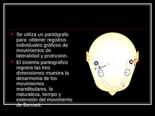  Se utiliza un pantógrafo
para obtener registros
individuales gráficos de
movimientos de
lateralidad y protrusion.
 El sistema pantografico
registra las tres
dimensiones muestra la
desarmonia de los
movimientos
mandibulares, la
naturaleza, tiempo y
extensión del movimiento
de Bennett.
 